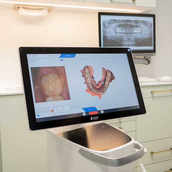 Kieferorthopädie ohne Abdruck mit 3D Scanner