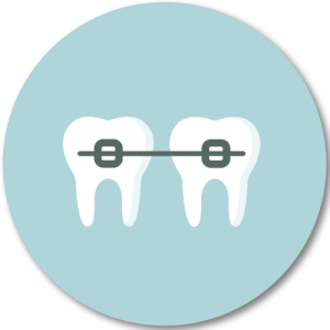 Feste Spange zur Korrektur von Zahnfehlstellungen