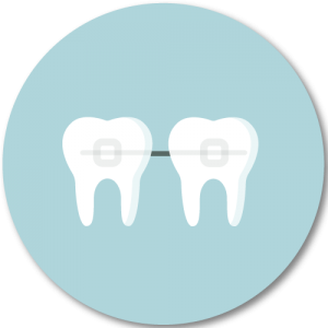 Lingultechnik zur Korrektur von Zahnfehlstellungen